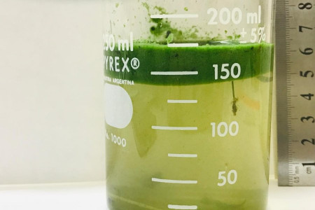 Cianobacterias un riesgo para lagunas y ríos del NEA que requiere acciones de monitoreo y visibilidad